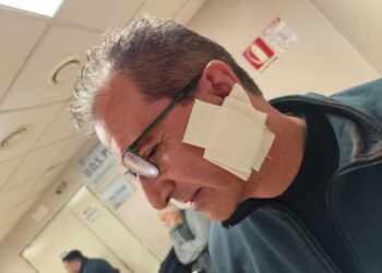 Quarto (Na), Nonno (FdI): «Condanniamo fermamente l’aggressione con machete, solidarietà al lavoratore»